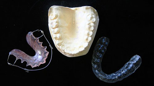 ortodoncija.jpg